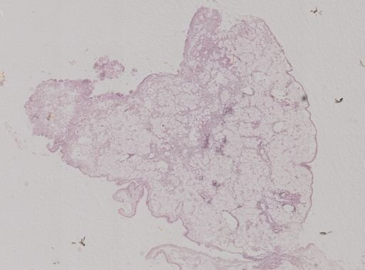 Modiolus