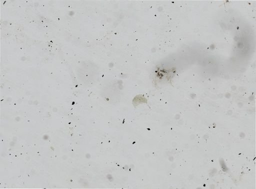 Bacteria