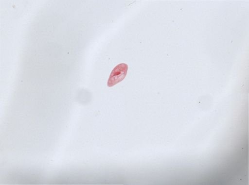 Paramecium aurelia