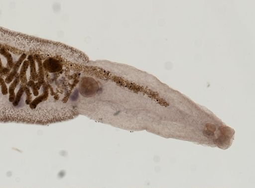 Clonorchis sinensis