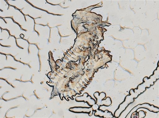 Onchidoris muricata