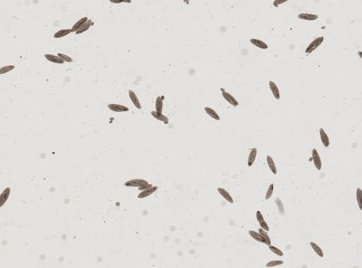 Paramecium caudatum