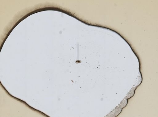 Keratella quadrata