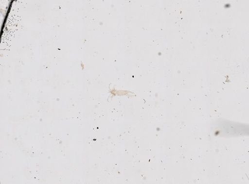Anomalohalacarus anomalus