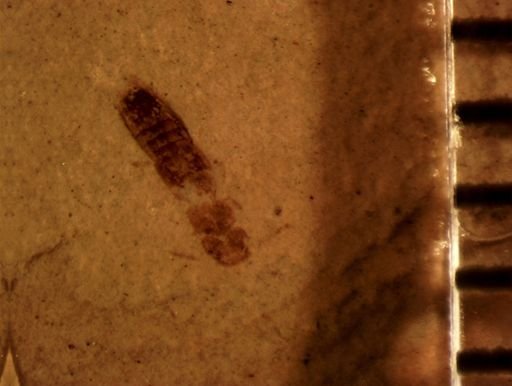 undet. Staphylinidae