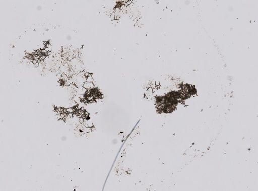 Leucosolenia