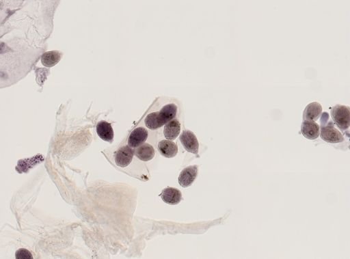 Echinococcus