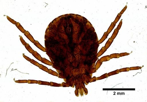 Dermacentor andersoni