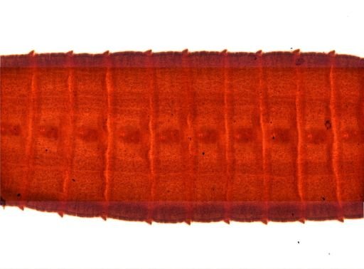 Diphyllobothrium erinacei