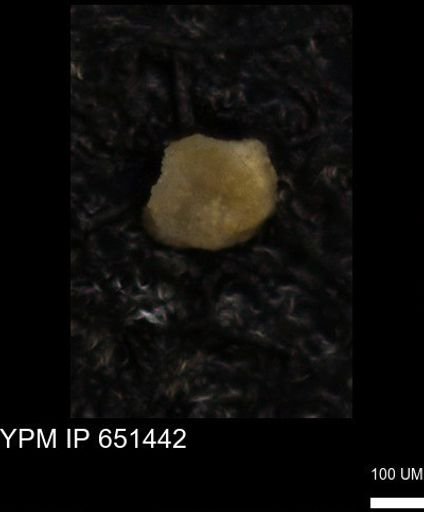 Foraminiferida?