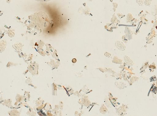 Ascaris lumbricoides