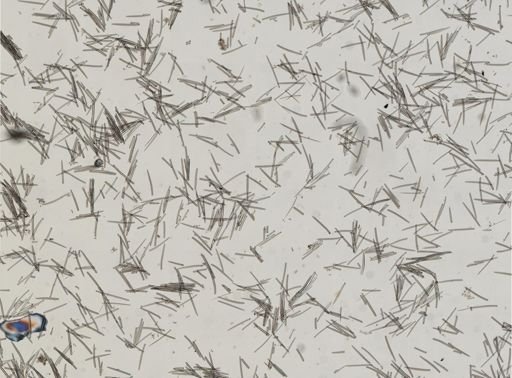 Isodictya deichmannae