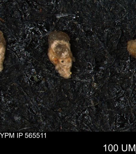 Verneuilina canadensis