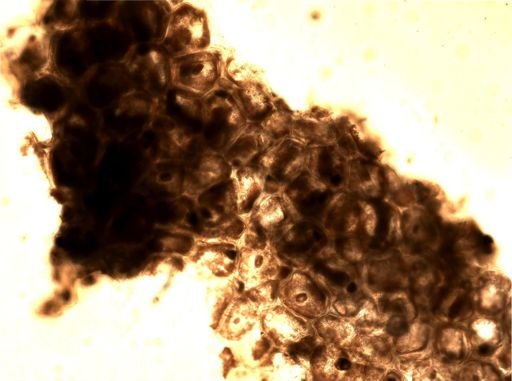 Alcyonidium