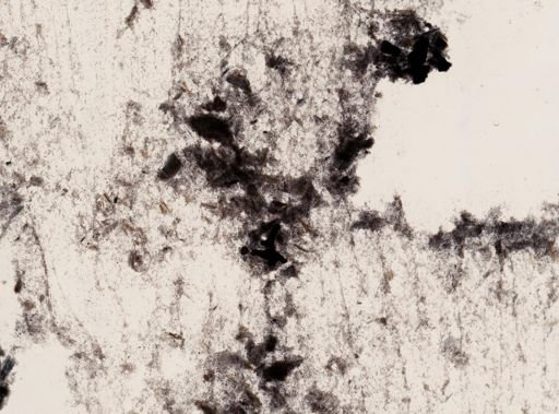 Trichomonas