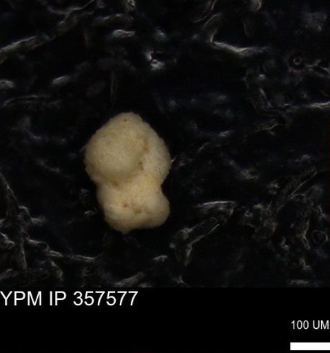 undet. Foraminiferida
