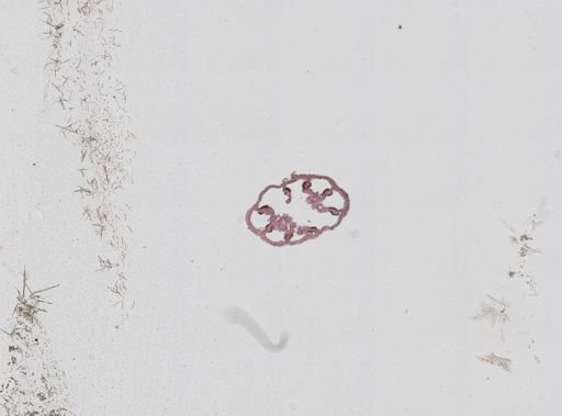 Nematostella