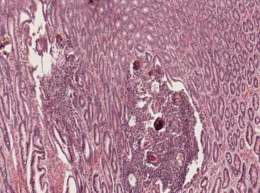 Schistosoma japonicum