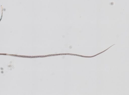 Trichinella spiralis