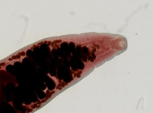 Haematoloechus medioplexus