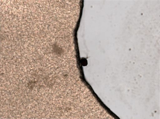 Ploesoma triacanthum