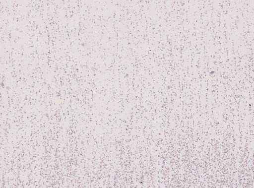 Plasmodium relictum