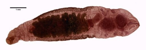 Clonorchis sinensis