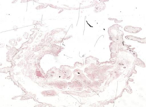 Thysanozoon brocchii