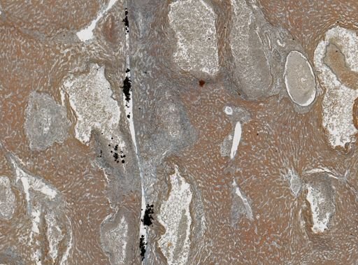 Taenia crassicollis