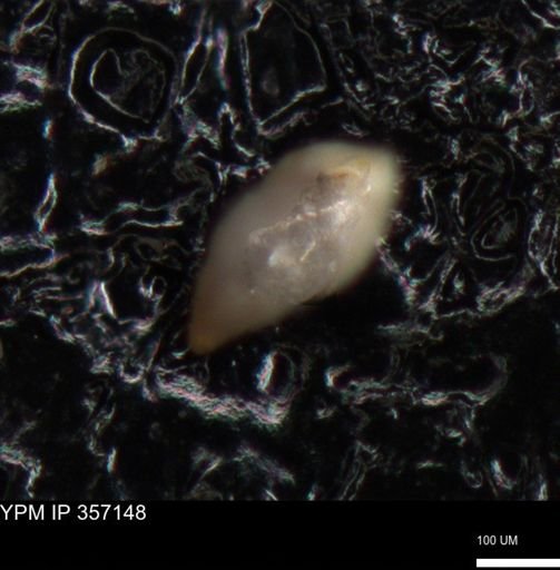 undet. Foraminiferida