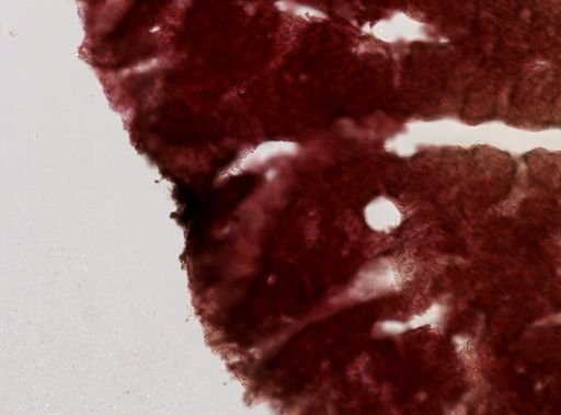 Plakortis sp.