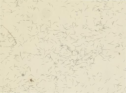 Haliclona oculata