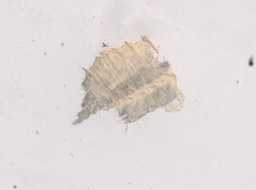 Cirriformia filigera