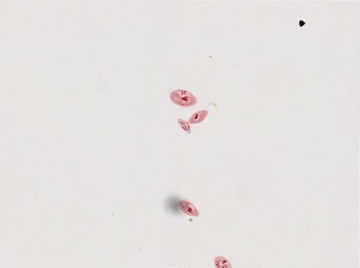 Paramecium calkinsi