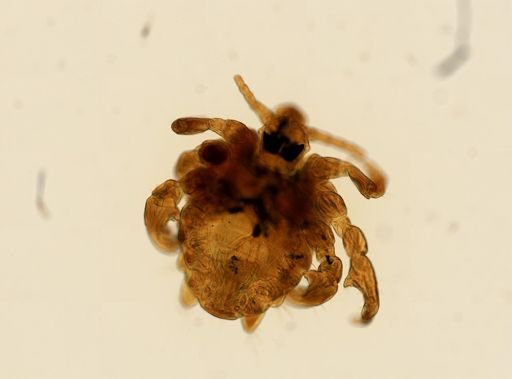 Pthirus pubis