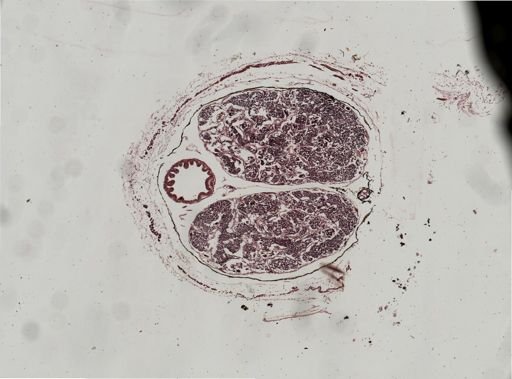 Linophryne