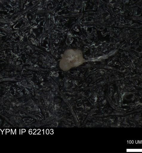 undet. Rugoglobigerinidae