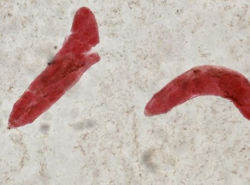 Fasciola hepatica