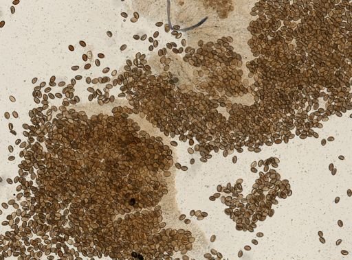 Dicrocoelium dendriticum