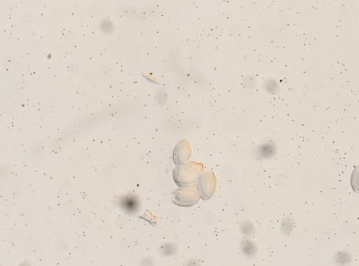 Macracanthorhynchus hirudinaceus