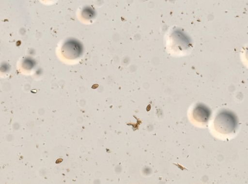 Diphyllobothrium canis