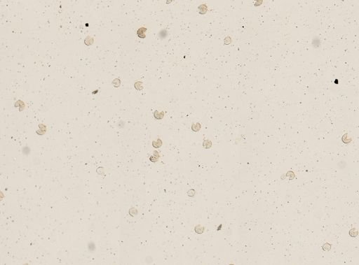 Taenia saginata