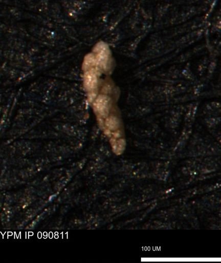 Verneuilina canadensis