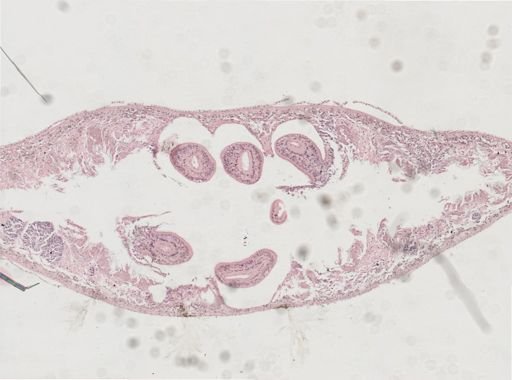 Phagocata gracilis