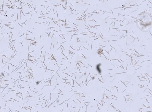 Haliclona oculata