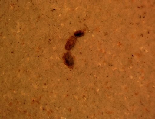 undet. Hymenoptera