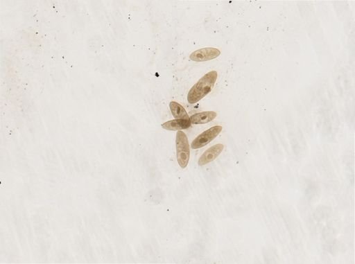 Paramecium woodruffi