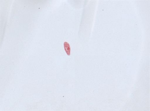 Paramecium aurelia