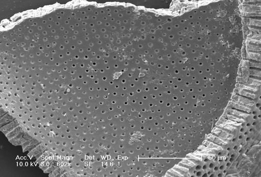 undet. Foraminiferida