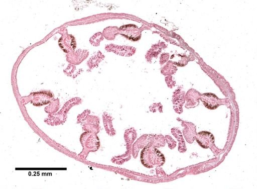 Nematostella